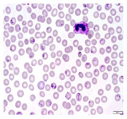  Plasmodium! A Microscopic Predator That Hijacks Our Cells